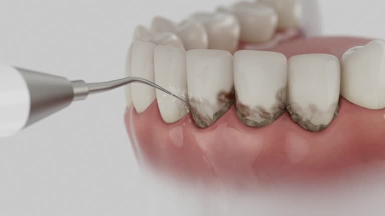 Reliable Teeth Cleaning And Checkup contractor in Faulk County County, SD by Dentist Open Now